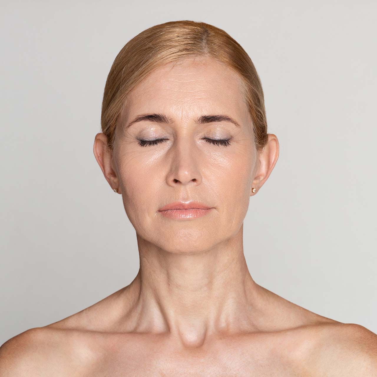 Visage de femme illustrant la nouvelle technologie Sofwave offerte par Concept Clinic pour rajeunir la peau du visage